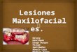Lesiones Maxilofacial Medicina Legal