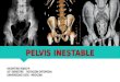 Pelvis Inestable