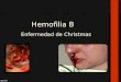 Hemofilia B.pptx