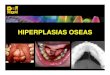 HIPERPLASIAS OSEAS.pdf