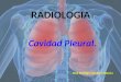 2- cavpleural-090907175026-phpapp02.ppt