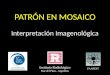 PATRÓN EN MOSAICO Interpretación Imagenológica Instituto Radiológico Mar del Plata - Argentina FAARDIT