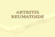 ARTRITIS REUMATOIDE. Enfermedad Inflamatoria Sistémica (articulaciones)Enfermedad Inflamatoria Sistémica (articulaciones) Sinovitis Poliarticular simétrica,