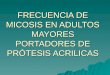 FRECUENCIA DE MICOSIS EN ADULTOS MAYORES PORTADORES DE PRÓTESIS ACRILICAS