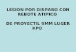 LESION POR DISPARO CON REBOTE ATIPICO DE PROYECTIL 9MM LUGER KPO