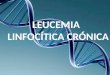¿Qué es?  La leucemia linfocítica crónica es un tipo de cáncer en el cual la médula ósea produce demasiados linfocitos.  Alteraciones en diversos genes