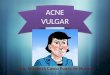Dra. Elizabeth Casco Funes de Nunez ACNE VULGAR. Acne Enfermedad cutánea crónica del folículo pilo sebáceo (formado por el folículo piloso+ zona de la