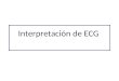 Interpretación de ECG. El latido Importante. Triángulo de Einthoven
