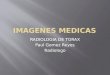 RADIOLOGIA DE TORAX Paul Gomez Reyes Radiologo.  IMAGEN CARDIACA DIAGNOSIS SEVERIDAD DE LA ENFERMEDAD COMPLICACION SUGERIR TX ADECUADO