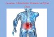Lesiones Vertebrales Dorsales a Nivel Óseo. ¿Qué es la columna vertebral? La columna vertebral, raquis o espina dorsal es una compleja estructura osteofibrocartilaginosa