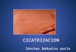 CICATRIZACION Sánchez Bañuelos perla. La cicatrización es la respuesta normal a una lesión. Cicatrización aguda de las heridas: ₋Extensión ₋Tejido ₋Enfermedades