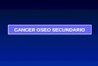 CANCER OSEO SECUNDARIO. Es el más frecuente de los tumores óseos Bologne