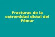 Fracturas de la extremidad distal del Fémur. Clasificación de las fracturas de la extremidad distal del fémur Supracondíleas : 45% Supra e intercondíleas