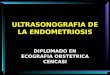 ULTRASONOGRAFIA DE LA ENDOMETRIOSIS DIPLOMADO EN ECOGRAFIA OBSTETRICA CENCASI
