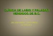 CLÍNICA DE LABIO Y PALADAR HENDIDOS DE B.C. DR. HECTOR G. LINO ORTIZ COORDINADOR DR. HECTOR G. LINO ORTIZ COORDINADOR