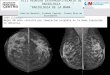 CASO CLINICO: Mujer 60 años consulta por tumoración palpable en la mama izquierda, no dolorosa. VIII REUNION INTERHOSPITALARIA DE RADIOLOGIA “RADIOLOGIA