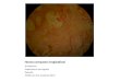 Hueso compacto longitudinal Se observan: Osteocitos en sus lagunas Periostio Teñido con H/E. Aumento 100 X