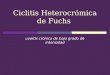 Ciclitis Heterocrómica de Fuchs uveítis crónica de bajo grado de intensidad