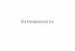 Osteoporosis. Osteoporosis es una disminucion progresiva de la masa osea, que hace que los huesos se vuelvan mas fragiles y propensos a las fracturas
