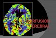 TC PERFUSIÓN CEREBRAL PRINCIPIOS BÁSICOS  La perfusión del tejido cerebral normal se mantiene dentro de un rango muy estrecho por la autorregulación