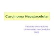 Carcinoma Hepatocelular Facultad de Medicina Universidad de Córdoba 2009