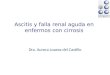 Ascitis y falla renal aguda en enfermos con cirrosis Dra. Aurora Loaeza del Castillo