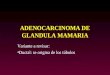 ADENOCARCINOMA DE GLANDULA MAMARIA Variante a revisar: Ductal: se origina de los túbulos