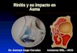 Rinitis y su impacto en Asma Dr. German Gago Corrales Asistente ORL – HCG