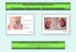 Sistema Endócrino Tiroides-Páncreas- Suprarrenales Càtedra de Anatomía y Fisiología Humana Profesora Liliana Sierra 2011