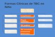 Formas Clínicas de TBC en Niño Formas clínicas de TUBERCULOSIS Pulmonares Complejo primario Forma pulmonar progresiva TBC pulmonar tipo adulto Formas diseminadas