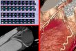 Nuevas estrategias en imagen cardiovascular para reducir la exposición a radiación Dr. Erick Alexanderson Rosas