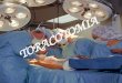 Una toracotomía es un procedimiento quirúrgico para abrir el pecho, con el propósito de acceder a los pulmones, esófago, tráquea, aorta, corazón y diafragma