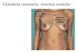 Glándula mamaria: sistema nodular. Glándula mamaria humana: sudorípara modificada