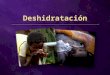 Deshidratación. 70% agua 70% agua ¿Cuál es la causa de la deshidratación? No tomar suficiente agua Sudar bastante Diarrea o vómito Demasiado enfermo