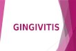 GINGIVITIS. DEFINICIÓN se conoce como gingivitis a una hinchazón de características patológicas que se produce en las encías debido, por lo general, a