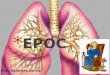 Ruth Sarantes Dávila. * La Enfermedad Pulmonar Obstructiva Crónica (EPOC) se define actualmente como una patología prevenible y tratable, caracterizada