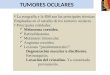 TUMORES OCULARES La ecografía y la RM son las principales técnicas Empleadas en el estudio de los tumores oculares. Principales entidades: Melanoma coroideo