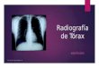 Radiografía de Tórax AGOSTO 2015 Dr. Luis M. Alcalá Valdés / nrr