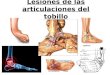 Lesiones de las articulaciones del tobillo. ¿Qué son las lesiones articulares? La tibia y el peroné hace dos movimientos: flexión dorsal y flexión plantar