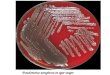 Pseudomonas aeruginosa  en agar sangre