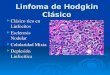 Linfoma de Hodgkin Clásico