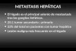 METASTASIS HEPÁTICAS