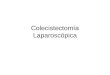 Colecistectomía Laparoscópica
