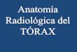 Anatomía Radiológica del TÓRAX