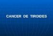 CANCER  DE  TIROIDES