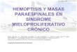HEMOPTISIS Y MASAS PARAESPINALES EN SÍNDROME MIELOPROLIFERATIVO CRÓNICO