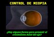 Control de la miopía