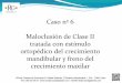 6.- Maloclusión de Clase II tratada con estímulo ortopédico del crecimiento mandibular y freno de
