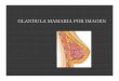 Glandula Mamaria Por Imagen