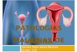 Patologias Malignas de La Vagina